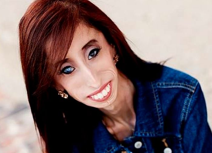 Lizzie Velasquez la forza della determinazione